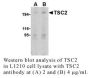 Anti-Human Tuberous Sclerosis Complex 2 (NT) (TSC2) - 0.1 mg