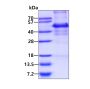 Recombinant human p62/SQSTM1 protein