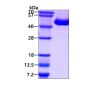 Recombinant human IL-12 p40 protein