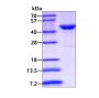 Recombinant human Casein kinase 2 alpha 2/CSNK2A2 protein