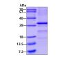 Recombinant human SSX1 protein