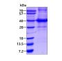 Recombinant human HLA-C protein