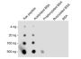 Anti-Acetyllysine Antibody Conjugated Agarose Beads