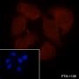 Anti-Ubiquitin Rabbit pAb (N-terminal)