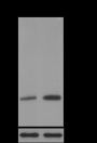 Anti-SUMO-1 Mouse mAb  (C-terminal)