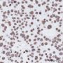 Anti-Ubiquityl-Histone H2A (Lys119) Rabbit mAb