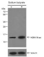 Anti-Acetyl-Histone H2B (Lys16) Rabbit pAb