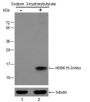 Anti-β-Hydroxybutyryl-Histone H2B (Lys15) Rabbit pAb
