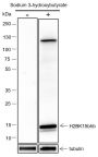 Anti-β-Hydroxybutyryl-Histone H2B (Lys15) Rabbit mAb
