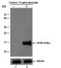 Anti-β-Hydroxybutyryl-Histone H3 (Lys9) Rabbit pAb