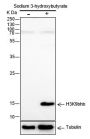 Anti-β-Hydroxybutyryl-Histone H3 (Lys9) Rabbit mAb