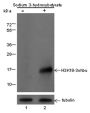 Anti-β-Hydroxybutyryl-Histone H3 (Lys18) Rabbit pAb