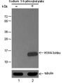 Anti-β-Hydroxybutyryl-Histone H3 (Lys4) Rabbit pAb