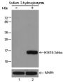 Anti-β-Hydroxybutyryl-Histone H3 (Lys18) Mouse mAb