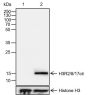 Anti-Citrulline-Histone H3 (Arg2/8/17) Rabbit mAb