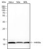 Anti-L-Lactyl-Histone H4 (Lys5) Rabbit mAb