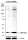 Anti-L-Lactyl-Histone H2B (Lys16) Rabbit mAb