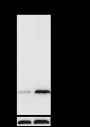 Anti-L-Lactyl-Histone H3 (Lys18) Rabbit mAb (ChIP Grade)