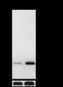 Anti-L-Lactyl-Histone H3 (Lys18) Rabbit mAb (ChIP Grade)