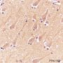 Anti-Methacryllysine Mouse mAb