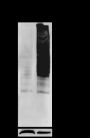 Anti-Carboxyethyllysine Rabbit mAb