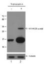 Anti-Acetyl-Histone H1.4 (Lys25) Rabbit pAb