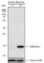 Anti-Acetyl-Histone H2B (Lys46) Rabbit pAb