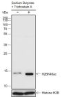 Anti-Acetyl-Histone H2B (Lys46) Rabbit pAb