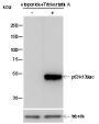 Anti-Acetyl-p53 (Lys139) Mouse mAb