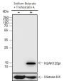 Anti-Propionyl-Histone H2A (Lys125) Rabbit mAb