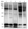 Anti-Butyryllysine Rabbit mAb