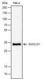 Anti-SUCLG1 Rabbit mAb