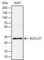 Anti-SUCLG1 Rabbit mAb