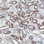 Anti-SUCLG1 Rabbit mAb