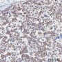 Anti-SUCLG1 Rabbit mAb