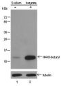 Anti-Butyryl-Histone H4 (Lys8) Rabbit pAb