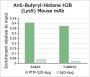 Anti-Butyryl-Histone H2B (Lys5) Mouse mAb
