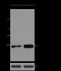 Anti-Butyryl-Histone H3 (Lys27) Mouse mAb