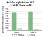Anti-Butyryl-Histone H2B (Lys23) Mouse mAb