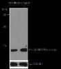 Anti-Succinyl-Histone H2B (Lys120) Rabbit pAb