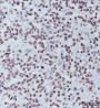 Anti-Trimethyl-Histone H3 (Lys27) Mouse mAb