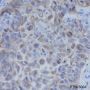 Anti-Keratin 5 Mouse mAb