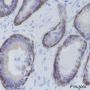 Anti-Keratin 5 Mouse mAb