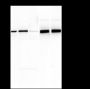 Anti-UQCRC2 Mouse mAb
