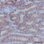 Anti-ATPB Mouse mAb