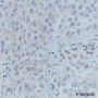 Anti-ATPB Mouse mAb