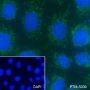 Anti-ATPB Mouse mAb