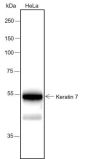 Anti-Keratin 7 Rabbit mAb