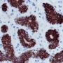 Anti-Keratin 7 Rabbit mAb