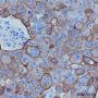 Anti-Keratin 7 Rabbit mAb